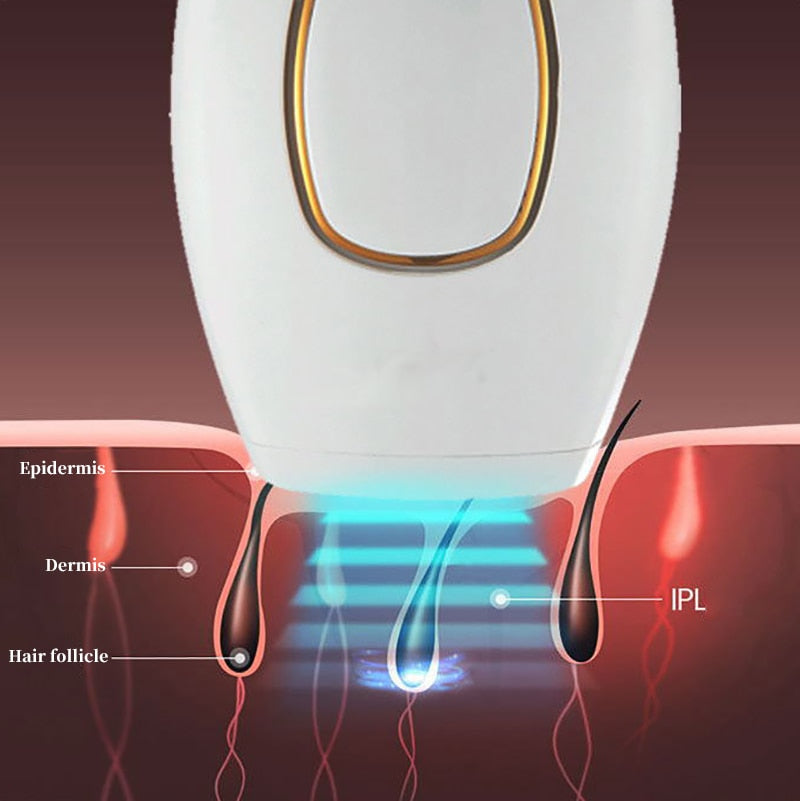 Depilador a Laser Definitivo Importado/LaserDepil - Acaso Das Mulheres Modernas